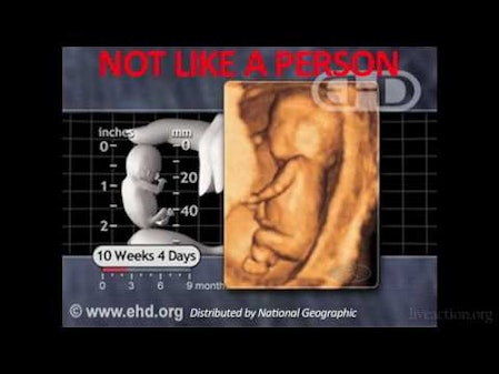 Indiana Planned Parenthood Caught On Tape Giving Fabricated Medical Information thumbnail