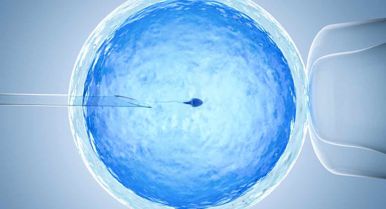 IVF, abort, sperm donation, egg donation, Nigeria