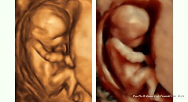 After an abortion and miscarriage, God opened her eyes to the truth image