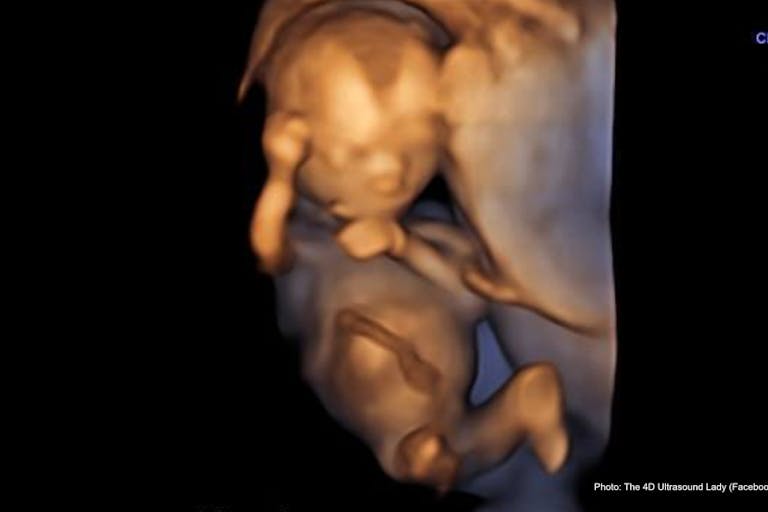 16 weeks gestation – 4D Ultrasound Lady Iowa prenatal education bill heads to governor’s desk featured image