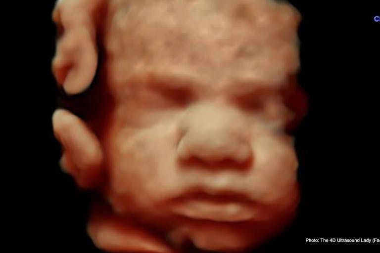 31 wks gestation – 4D Ultrasound Lady Third-trimester baby dies on floor after Singapore girl takes mail-order abortion drugs featured image