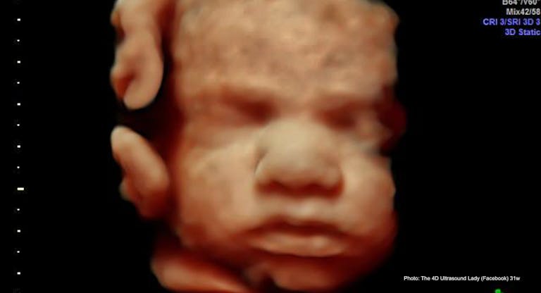 Third-trimester baby dies on floor after Singapore girl takes mail-order abortion drugs featured image