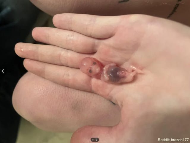 Some want the US to be like Sweden, aborting babies by pill though old enough to survive image