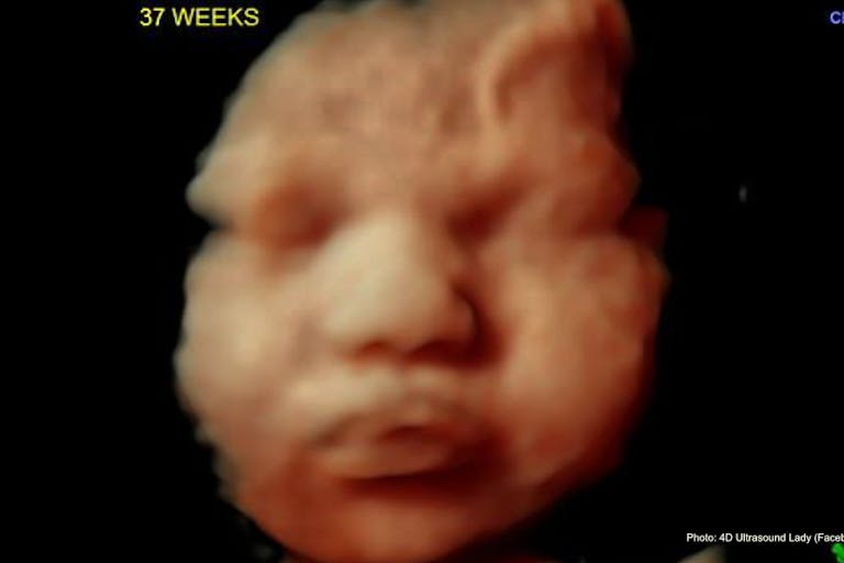 37 weeks 4D Ultrasound Lady