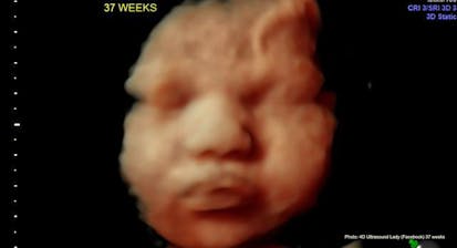 37 weeks 4D Ultrasound Lady