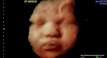 37 weeks 4D Ultrasound Lady