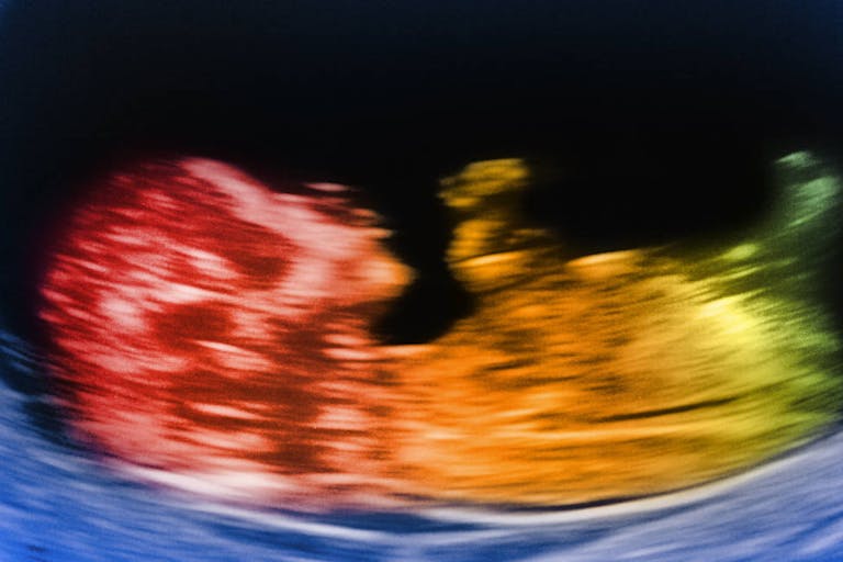 12 week old baby scan