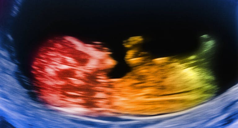 12 week old baby scan