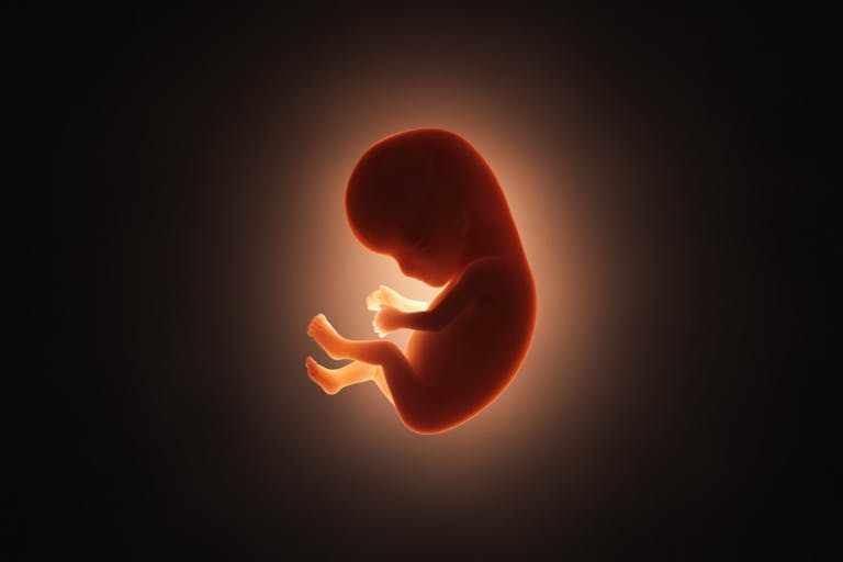 IVF