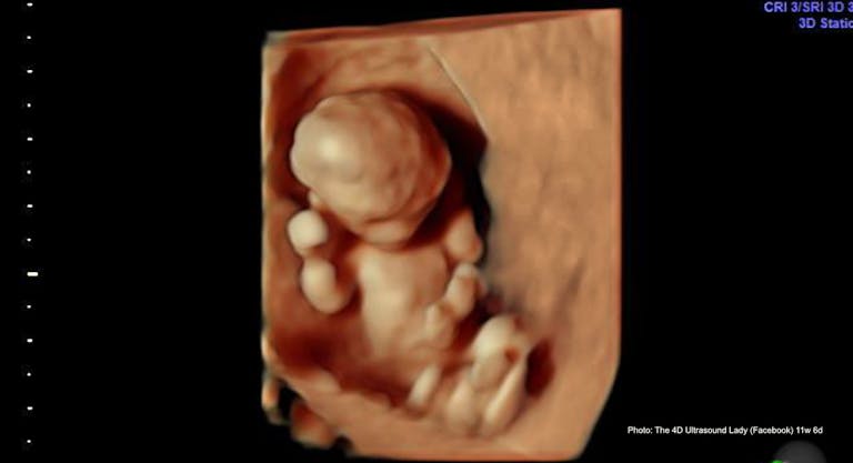 Mexican state of Yucatán is country’s latest to decriminalize abortion featured image