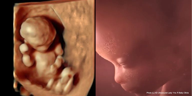 Baby Olivia and 4-D ultrasound 11wks gestation