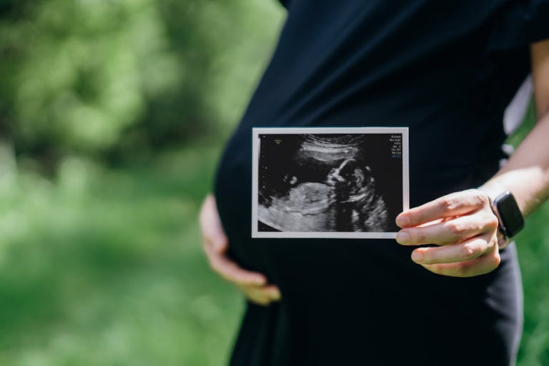 Close up of pregnant woman gently touching her belly while holding an ultrasound scan photo outdoors in the nature. Mother-to-be. Excited to become parents. Expecting a new life. Love and bonding concept