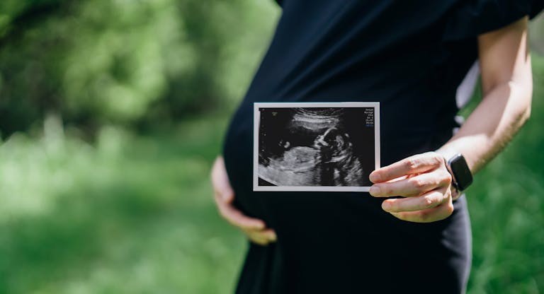 Close up of pregnant woman gently touching her belly while holding an ultrasound scan photo outdoors in the nature. Mother-to-be. Excited to become parents. Expecting a new life. Love and bonding concept