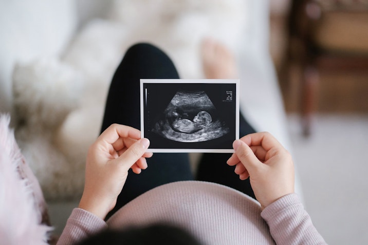 prenatal, abortion, down syndrome, pregnancy centers