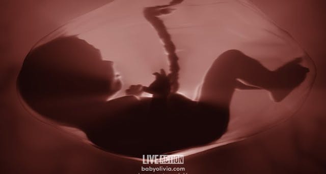 Previable Baby Olivia at 18 weeks after fertilization (20 weeks LMP) (Image credit Live Action) abortion, Baby Olivia, Florida, Utah