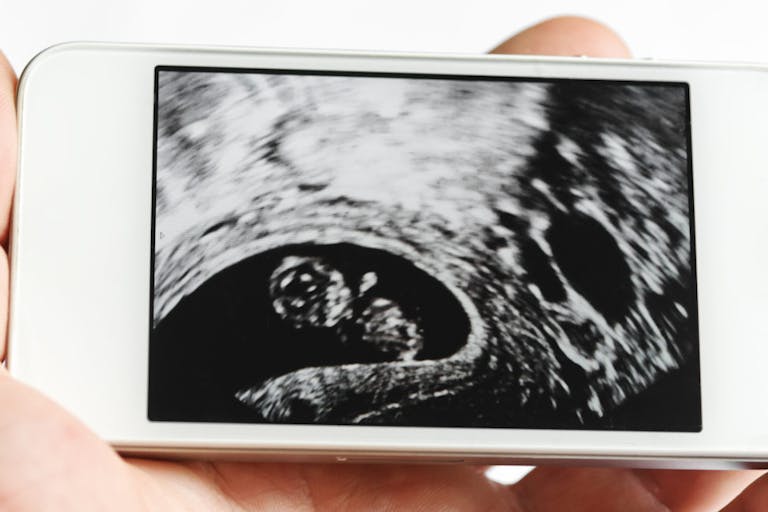 Ultrasound image on the smart phone