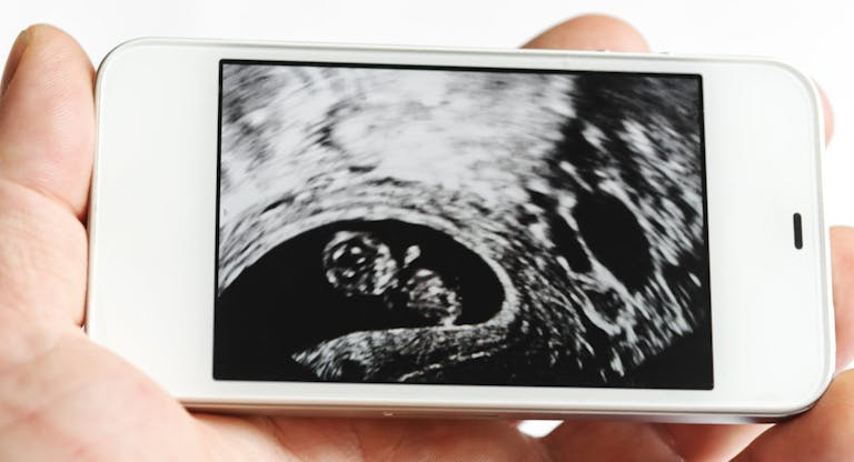 Ultrasound image on the smart phone