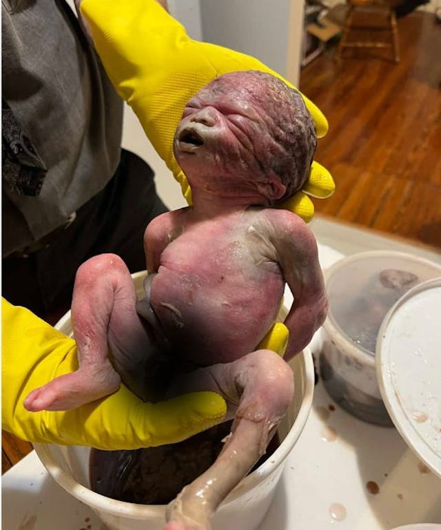 Christopher X was found in a medical waste box outside a DC abortion facility. Justice for the five