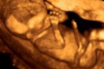 Planned Parenthood, abortion
