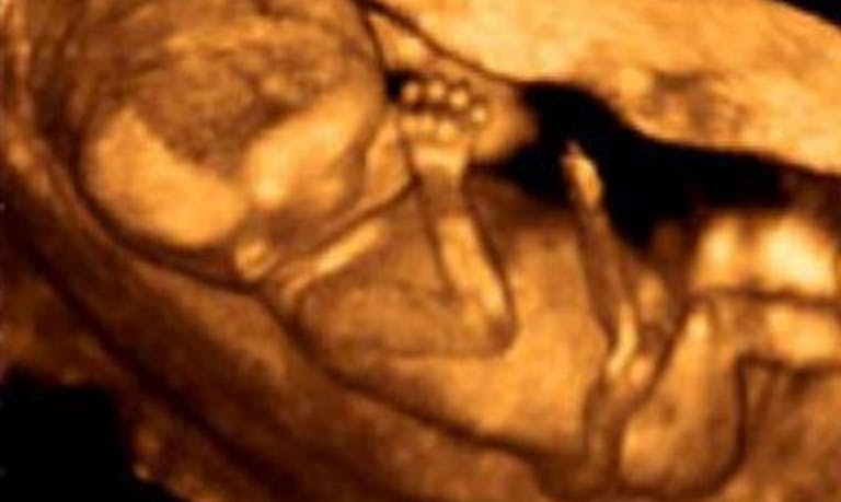Planned Parenthood, abortion