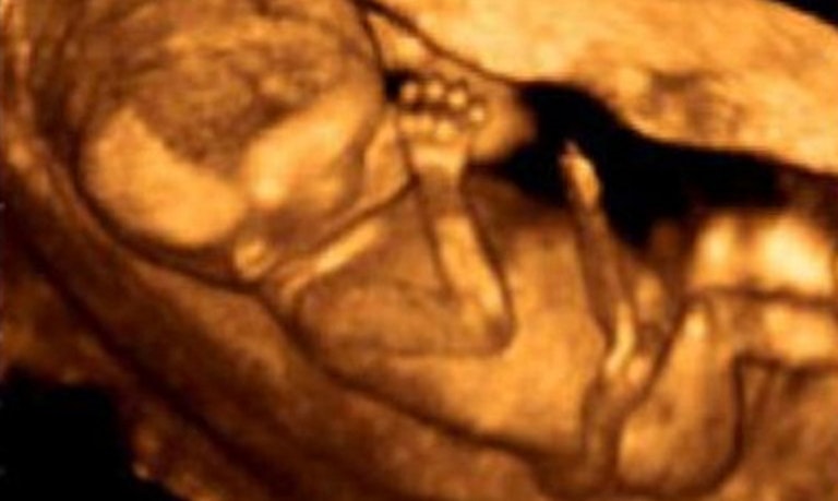 Planned Parenthood, abortion
