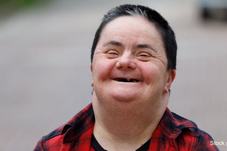 Woman with down syndrome smiling