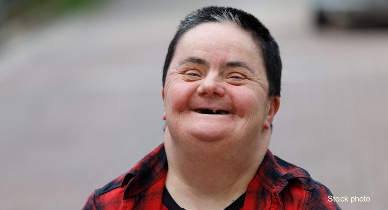 Woman with down syndrome smiling