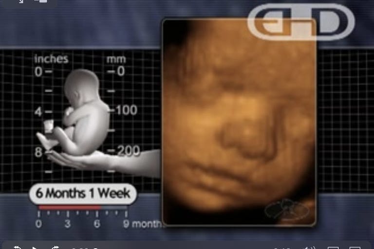 third trimester fetus ehd Georgia legislature introduces bill to make killing preborn children a ‘right’ featured image