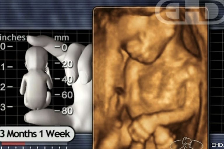 13 weeks post-fertilization, 15 weeks LMP UK man who drugged woman with abortion pill found guilty of ‘forced abortion’ image