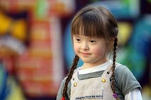 Down syndrome
