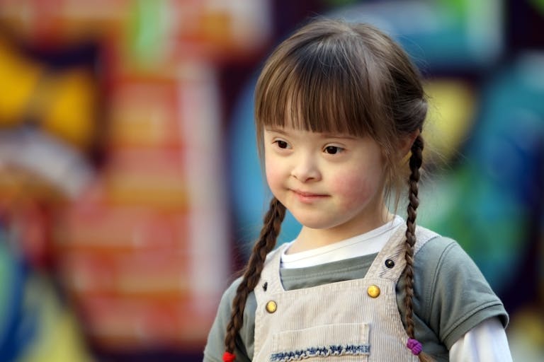 Down syndrome