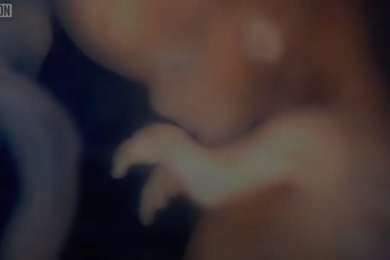 preborn baby first trimester blurred