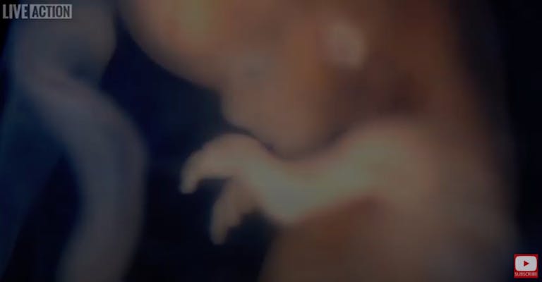 preborn baby first trimester blurred