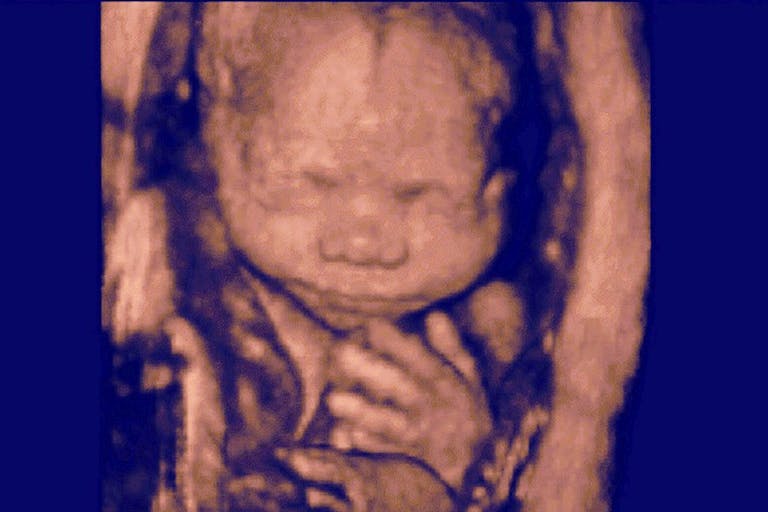 abortion, late-term, preborn, new hampshire, life resolution, preborn, fertility clinic, puerto rico, michigan
