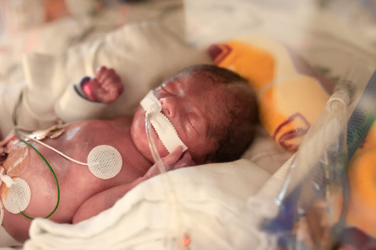 29 Week Premature Baby Is Seen in Hospital With Medical Equipment