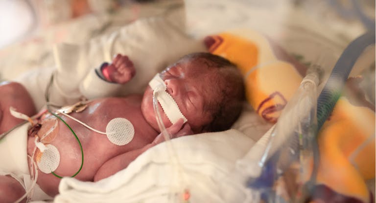 29 Week Premature Baby Is Seen in Hospital With Medical Equipment