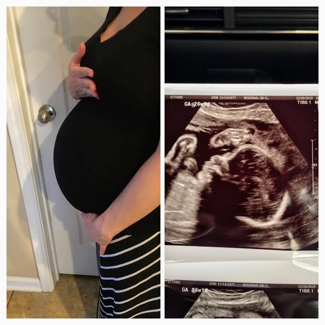 Melissa’s pregnancy bump and ultrasound at 26 weeks. Doctors said she was having a miscarriage – and she didn’t know she was pregnant image