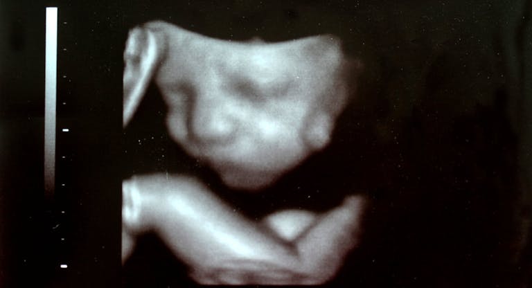 kid sonogram