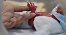 abortion survivors, premature, preemie,