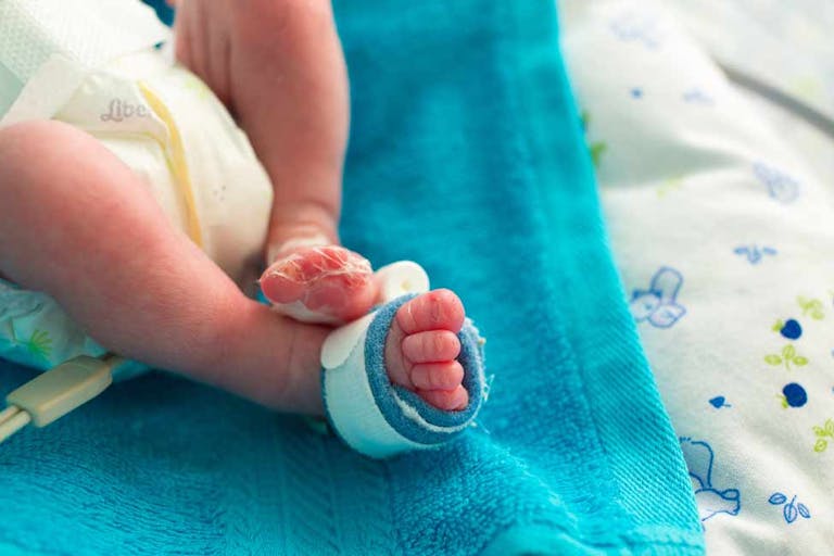 premature, late-term abortion, preterm, Massachusetts, new york, anencephaly, abortion survivors, abortion, baby girl, preemie