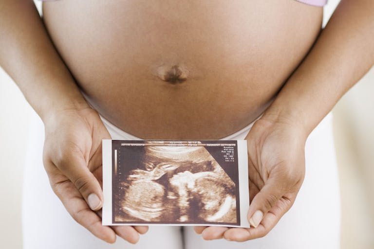 pro-life, Wisconsin, pregnant