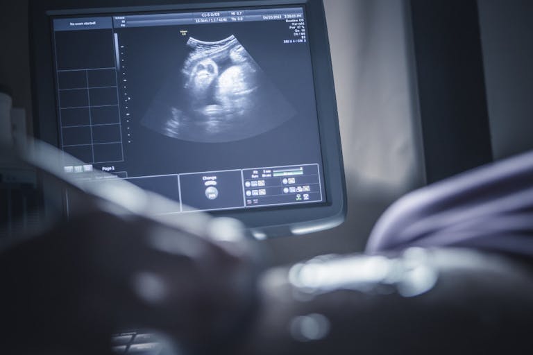 ultrasound, abortion, Polish