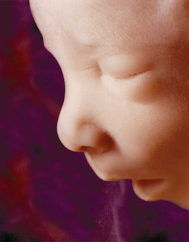 Preborn baby at 16 weeks Lila Rose defends life on Dr. Phil show: All humans have ‘a right to not be killed’ image