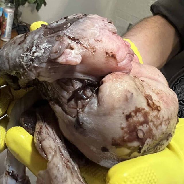 Baby Harriet side profile Photo courtesy of Progressive Anti-Abortion Uprising. Justice for the Five