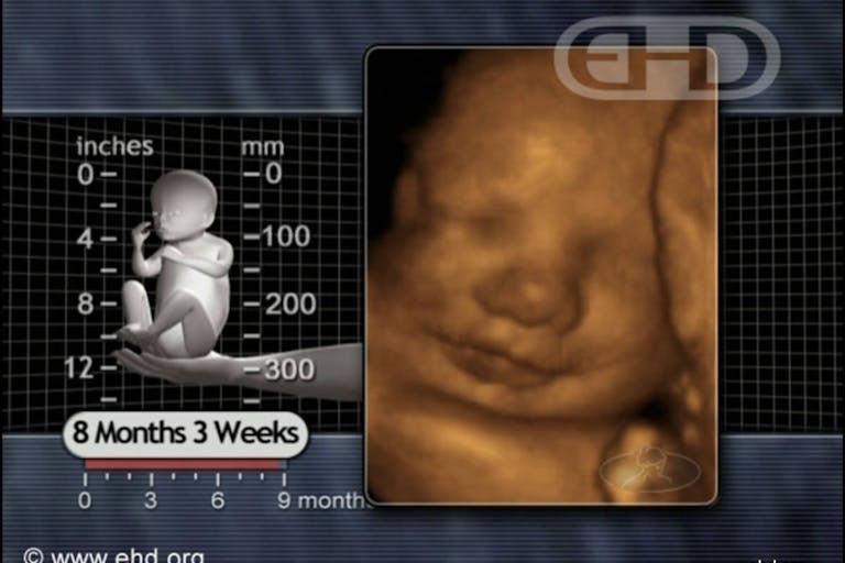8 months 3 weeks from fertilization EHD