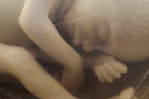 human-fetus-20-weeks, pro-life, abortion restrictions