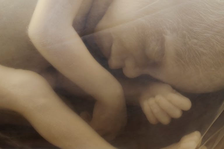 human-fetus-20-weeks, pro-life, abortion restrictions
