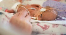 preemie, premature birth, pacemaker, adoption, premature