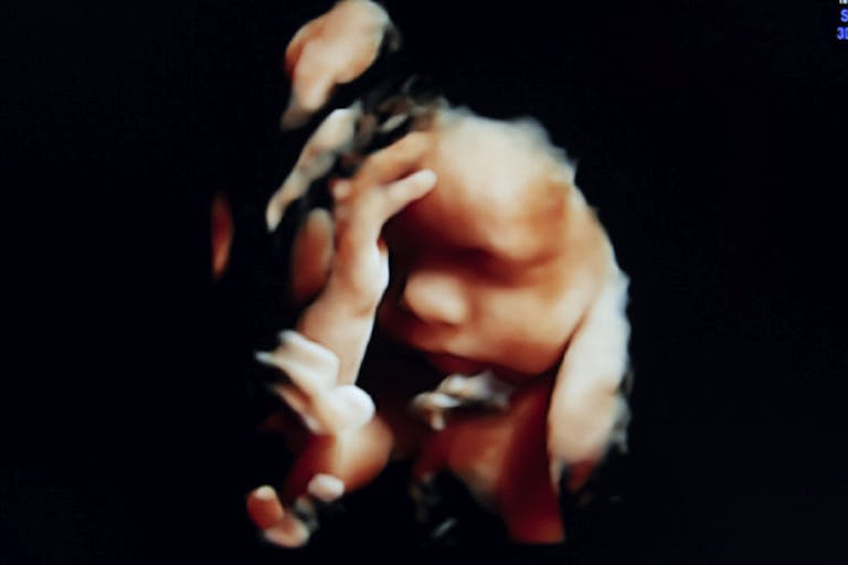 abortion