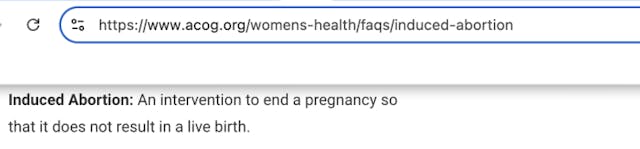 ACOG’s pro-abortion terminology has become ‘medically incoherent’ and ‘legally false’ image